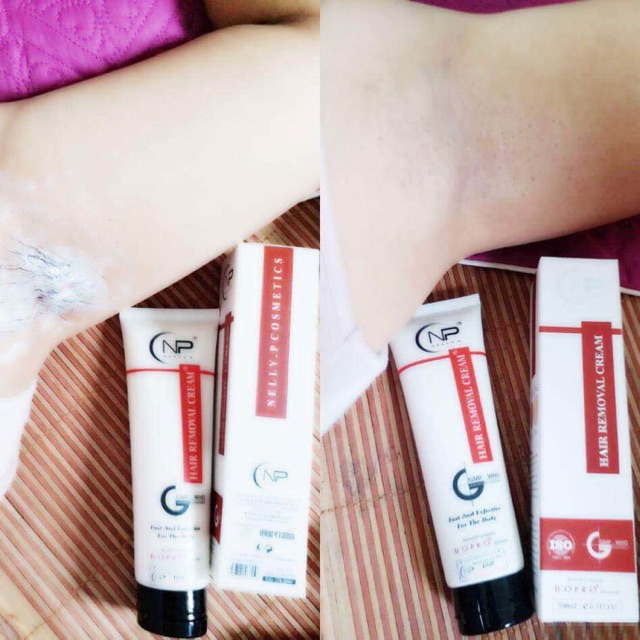 Triệt lông nelly.p( feeship)