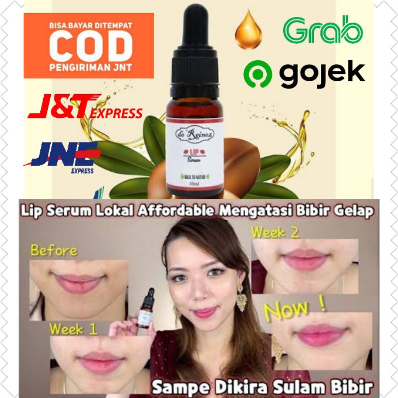 (hàng Mới Về) Serum De 'reinez D Dưỡng Ẩm Làm Sáng Màu Môi Đen Bpom De' Reinez