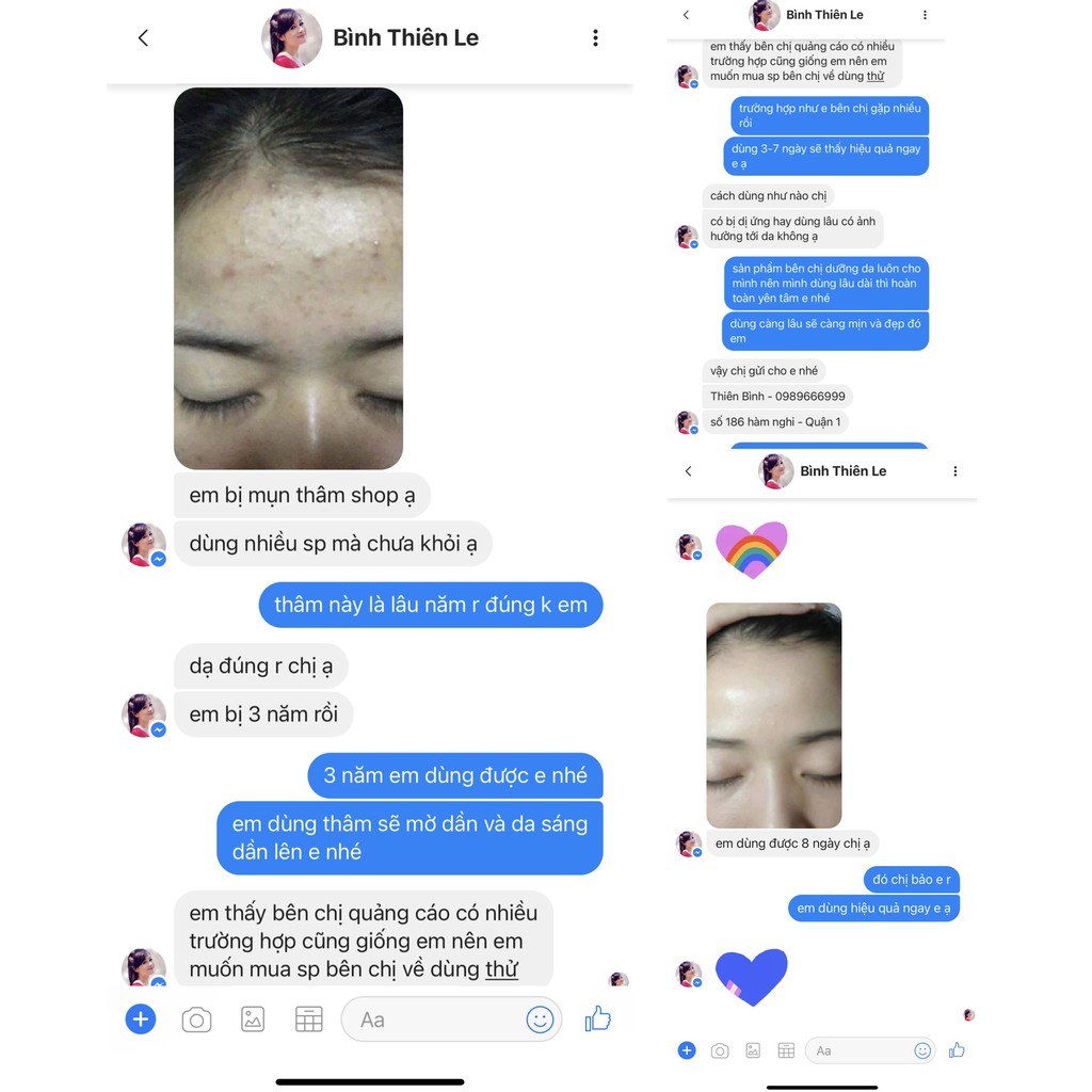 [Trị Mụn] Cao Lá Nam Chính Hãng Mix Saffron | BigBuy360 - bigbuy360.vn