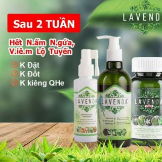Lavenda - hỗ trợ điều trị viêm nhiễm phụ khoa