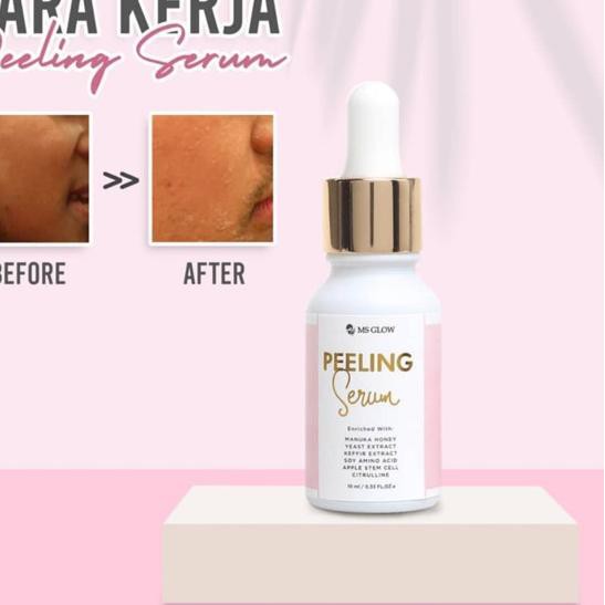 (Hàng Mới Về) Serum Dưỡng Da Mặt Today "Ms Glow Peel