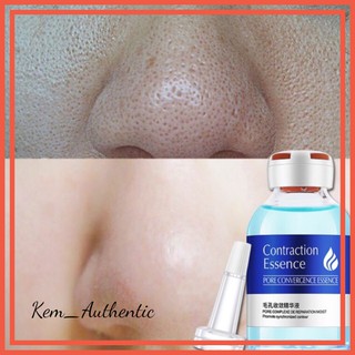 💎 Serum xanh se lỗ chân lông cấp nước cho da Cao Cấp 💦