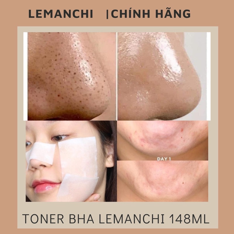  TRẢ ORDER * Toner BHA cao cấp Lemanchi 148ml