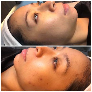 Sữa rửa mặt Surface radiance Medik8