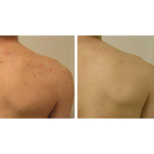 Xịt giảm mụn lưng, dưỡng trắng cơ thể Angel's Liquid Glutathione Plus Centella Calming Body Mist 150ml NPP Shoptido | BigBuy360 - bigbuy360.vn