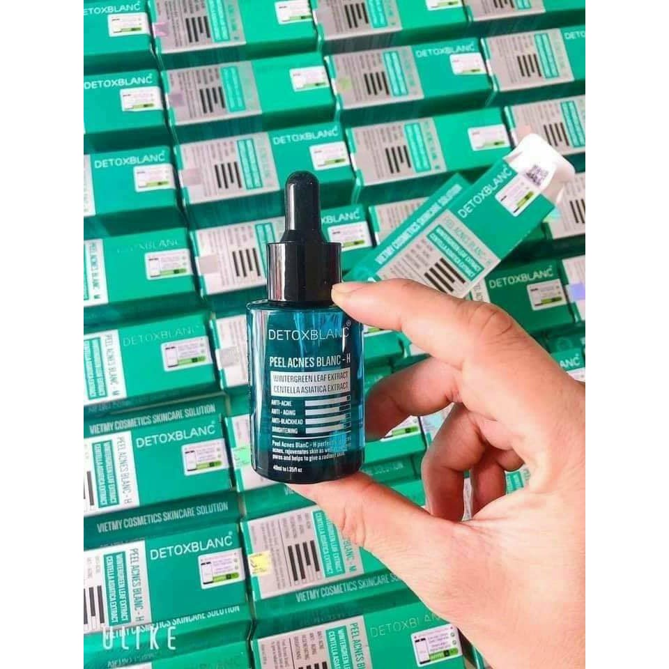 [chính hãng]SERUM MỤN DETOX BLANC (Mẫu mới 2020 Của Detox Blanc Số 13) | BigBuy360 - bigbuy360.vn