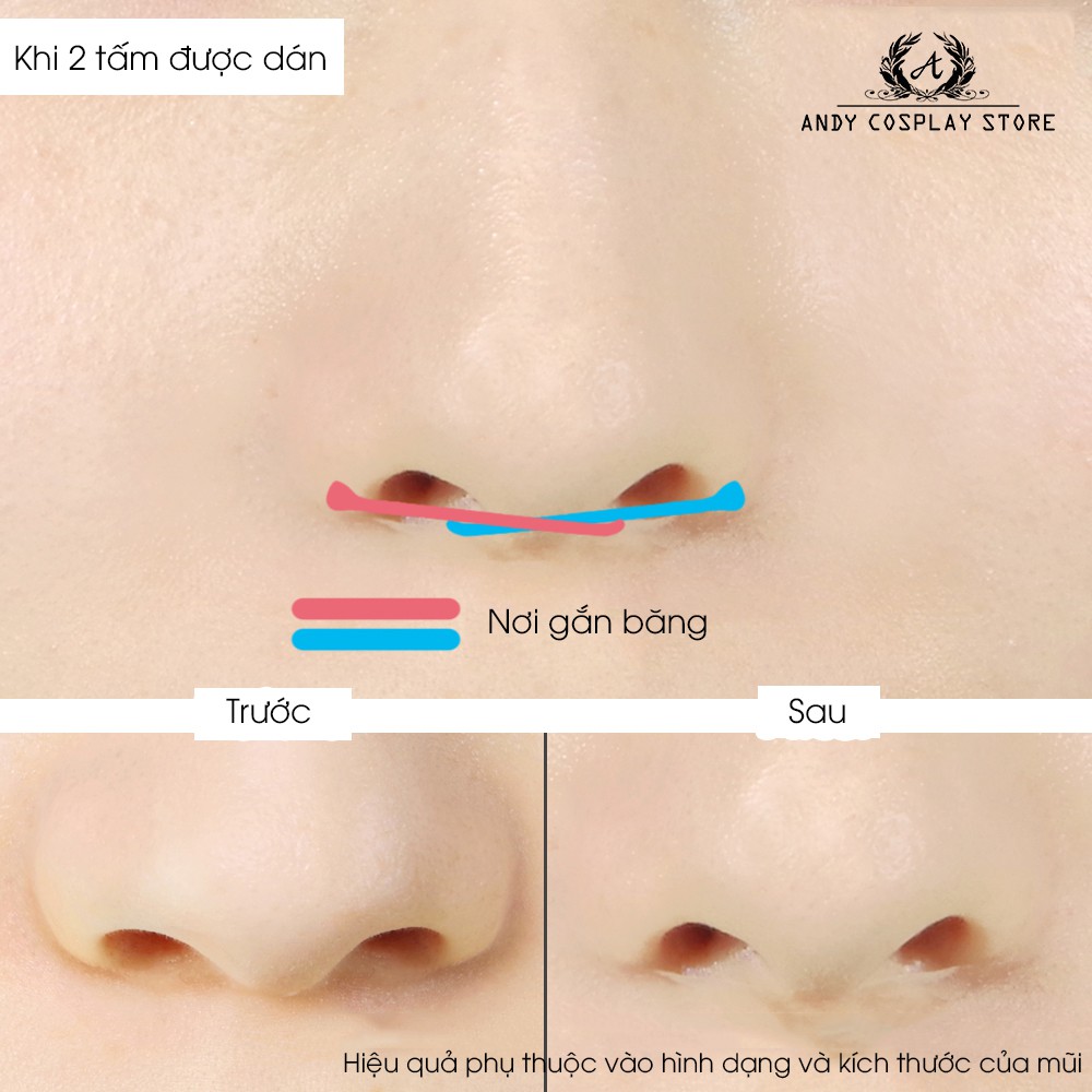 [CÓ SẴN] Miếng dán thu gọn mũi Assist Wig