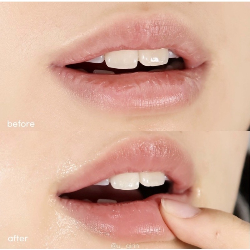 Mặt Nạ Môi Dạng Gel Prreti: Real Vita Hydrogel Lip Patch