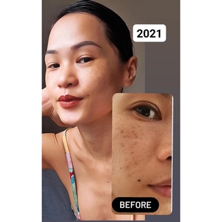 | NUSKIN | Máy Đẩy Tinh Chất AGELOC BOOST