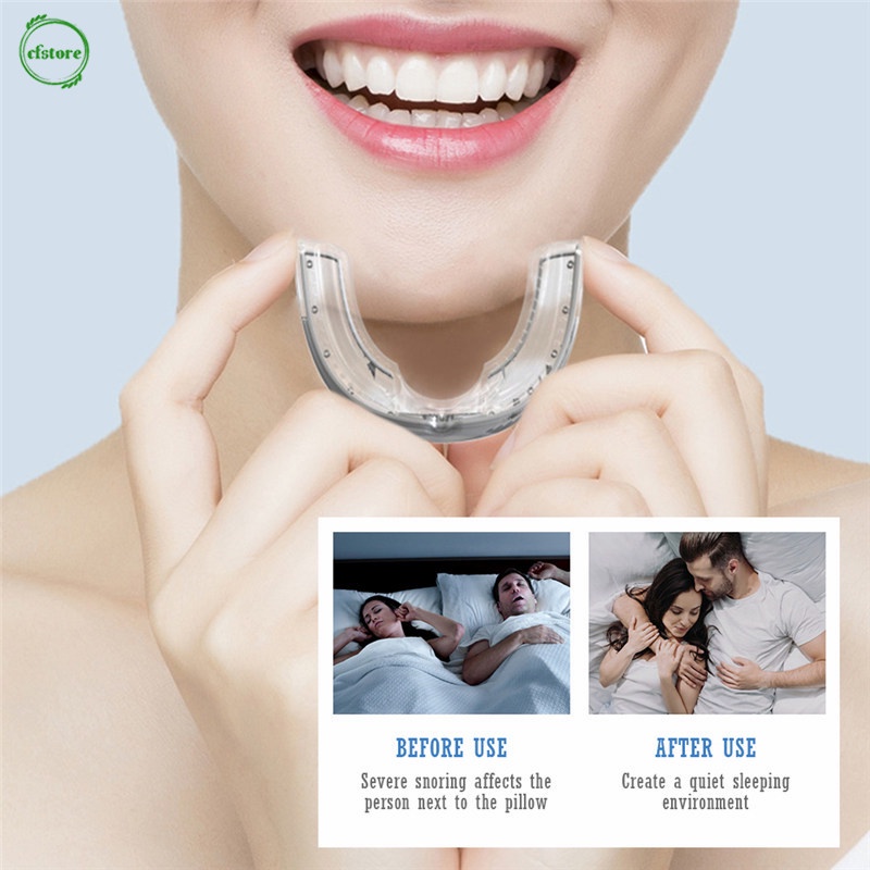 [Hàng mới về] Dụng cụ chống ngáy bằng silicon thiết kế nhỏ gọn tiện lợi