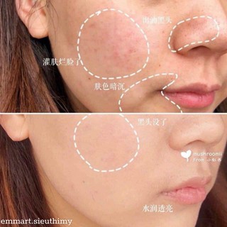 Serum Kiehl's Clearly Corrective Dark Spot Solution sáng da mờ thâm nám