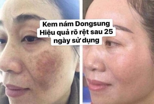 Kem mờ thâm, trắng da Dongsung 50g Hàn Quốc - Guu