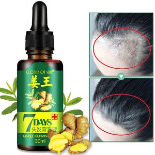 [Hàng mới về] Tinh dầu chăm sóc và kích thích mọc tóc 30ml