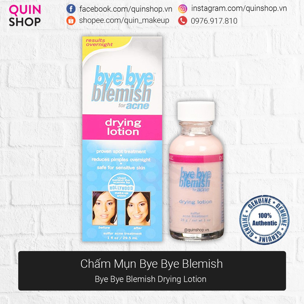 [Quinshop.vn] Lotion Làm Xẹp Mụn Sưng Cấp Tốc Bye Bye Blemish Drying Lotion