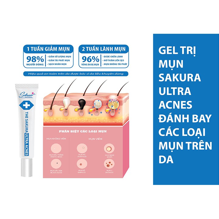 Kem The Sakura Ultra Acnes - Giúp Ngừa &  Hỗ Trợ Các Loại Mụn