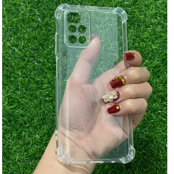 Ôp lưng Xiaomi redmi 10 silicon trong suốt bảo vệ camera Xiaomi redmi 10