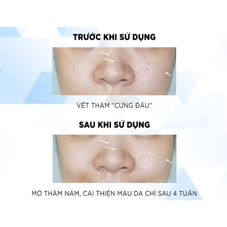 Kem Dưỡng Trắng, Mờ thâm, Nám Da Ban Đêm L'Oreal White Perfect Clinical Overnight 50ml