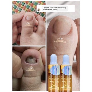 phục hồi móng hư tổn