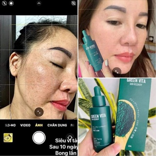 serum siêu vi tảo thay da sinh học kis22