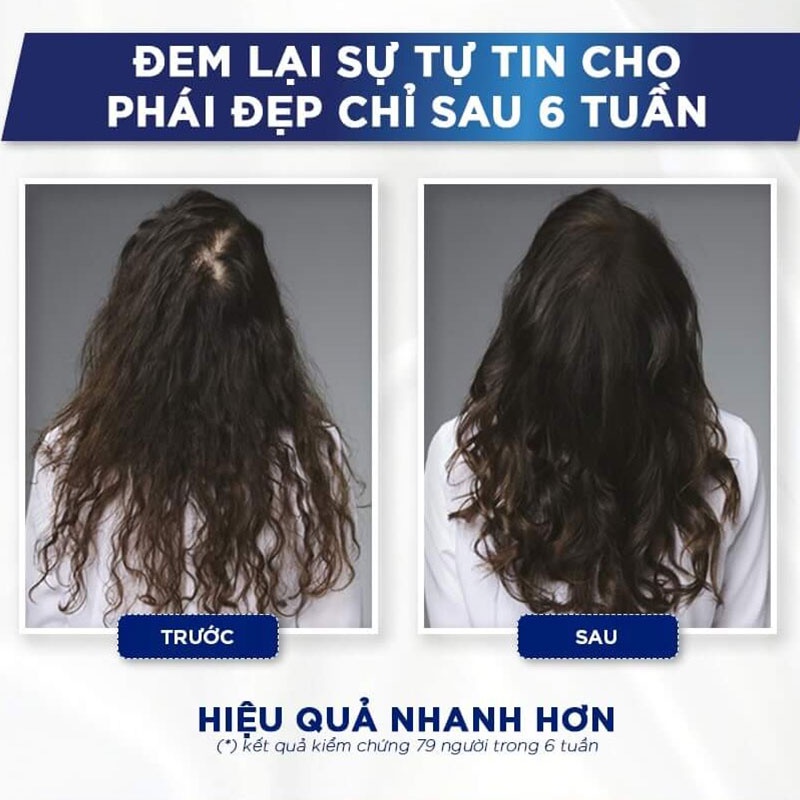 Tinh Chất L'Oréal Professionnel Kích Thích Mọc Tóc 90ml Serioxyl Denser Hair