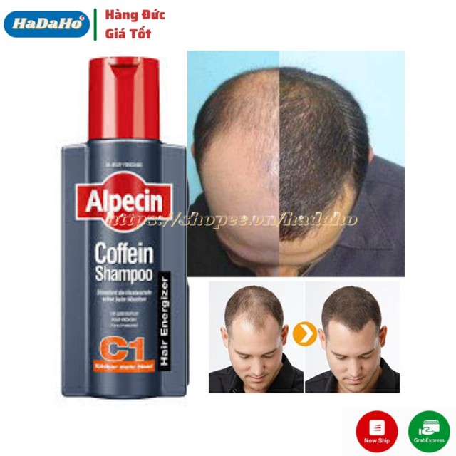 Bộ dầu gội và dưỡng chất Caffeine Alpecin cho tóc dầy hơn, chắc khỏe hơn, dành cho nam -Nội Địa Đức