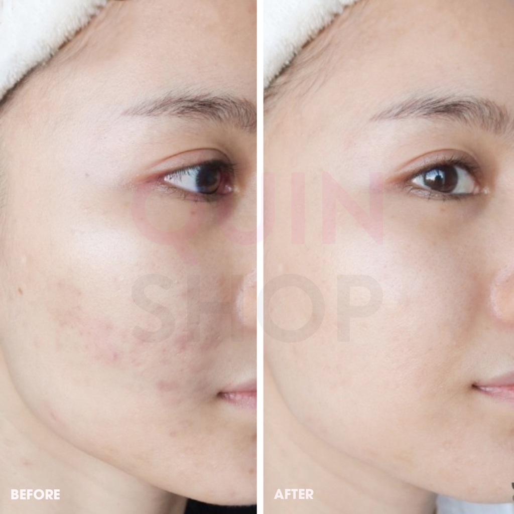 Tinh Chất Làm Sáng Da Neogen Real Vita C Serum