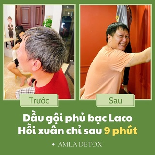 Dầu Gội Phủ Bạc Laco, Nhuộm Tóc Thảo Dược Phủ Bạc Đen Và Nâu Tóc Sau 9 Phút