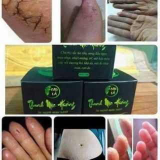 CAO BÔI DA -Trị nứt nẻ, rạn da, vết thương hở)