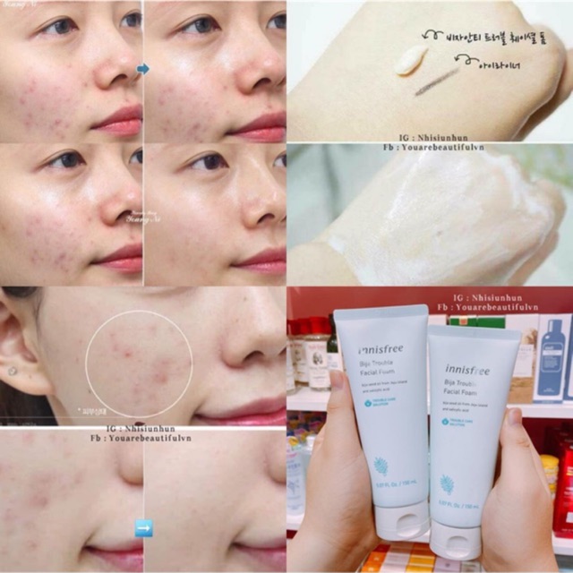 Sữa Rửa Mặt #Innisfree Bija Trouble Facial Foam