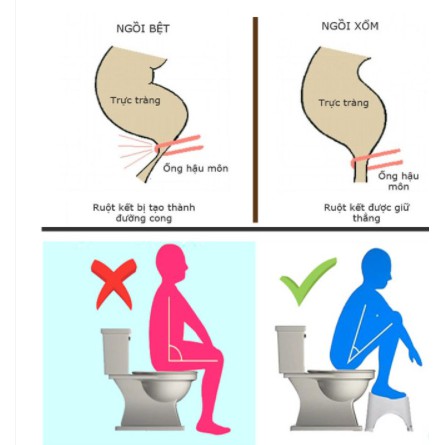 GHẾ KÊ CHÂN Toilet hiệu Song Long giúp ngồi đúng tư thế(ảnh thật)