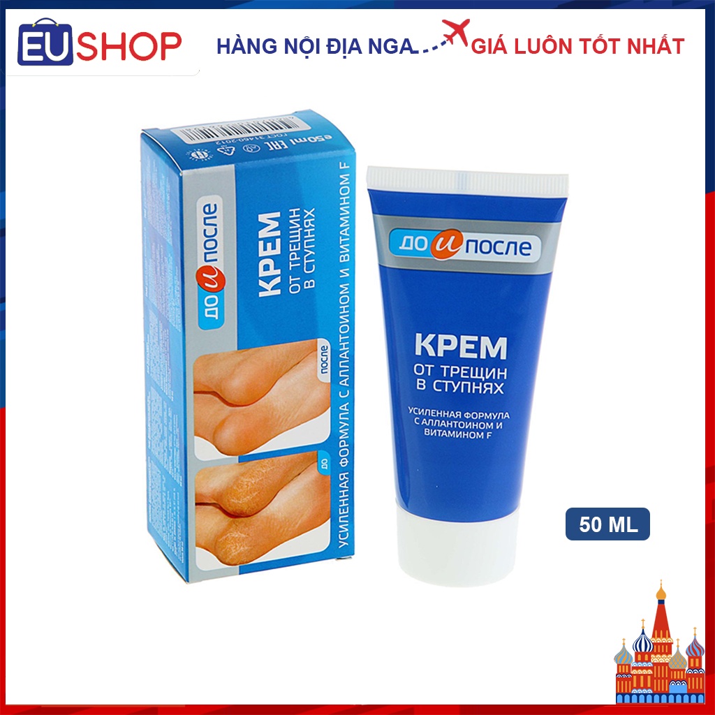 Kem nứt gót chân KPEM Nga Tuýp 50ml