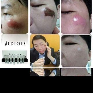 Tế bào gốc medigen