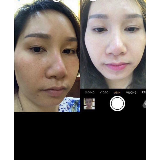 serrum thay da Nhân Sâm thảo dược đông y sạch mụn nám tái tạo da bong mạnh