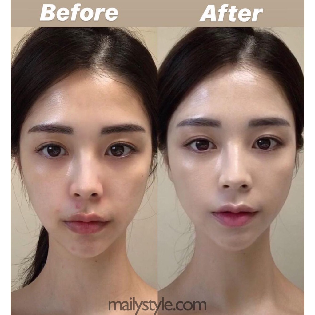 M27_Kem Retinal 1% Lumiderm màu ĐỎ