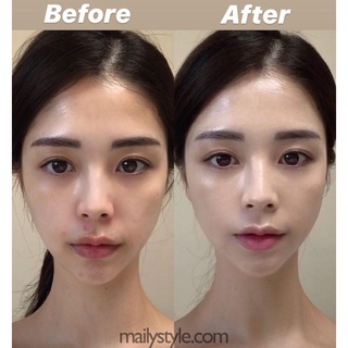 M27_Kem Retinal 1% Lumiderm màu ĐỎ