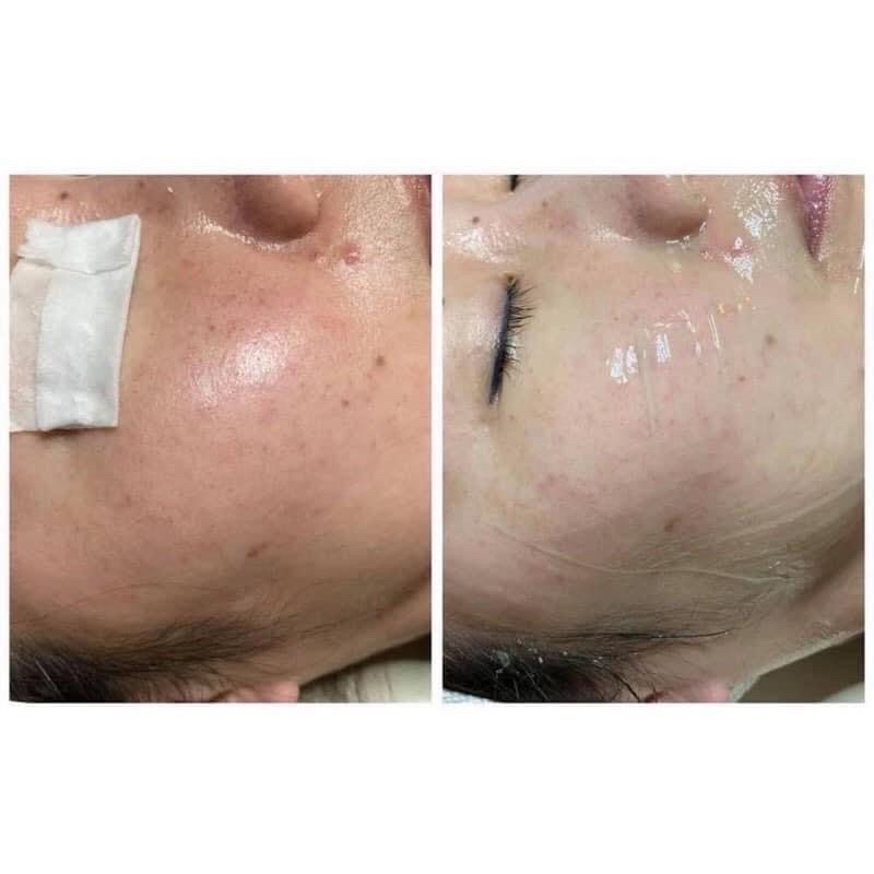 Mặt nạ phục hồi tái tạo và siêu cấp nước Glowbiotics Soothing Gel Mask