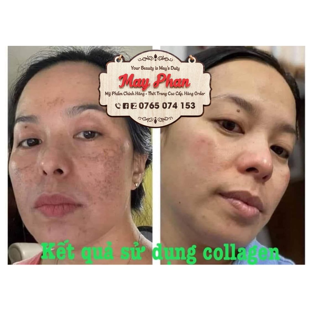 Collagen Plus Inner Focus Nuskin USA Collagen Bishin Tripeptide Collagen Nhật Bản