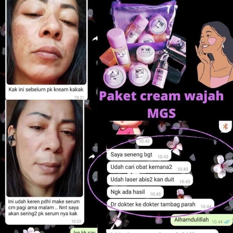 Kem MGS dưới nước | BigBuy360 - bigbuy360.vn