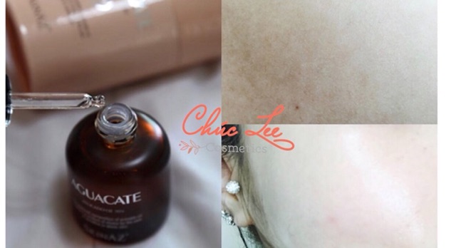 Tinh chất Bơ 99.6% Aguacate Skinaz dưỡng da cao cấp 30ml