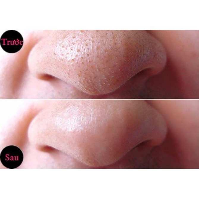 Miếng Dán Lột Mụn Mũi (Mụn Cám) Lô Hội, Than Hoạt Tính Mayan Hàn Quốc Hộp 4 Miếng | BigBuy360 - bigbuy360.vn