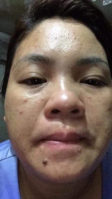 Ủ trắng da kén tằm( ủ là trắng) | BigBuy360 - bigbuy360.vn