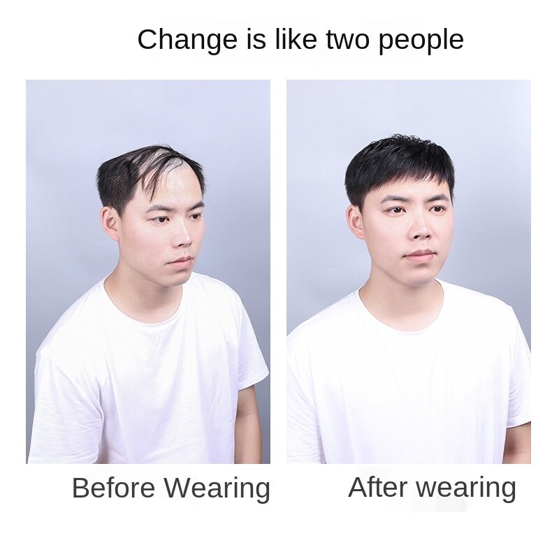 Tóc giả làm đẹp chuyên nghiệp cho nam