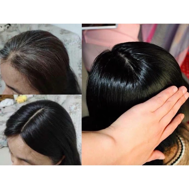 Che hói che đỉnh tóc thật 100% có da đầu loại cao cấp màu nâu đen