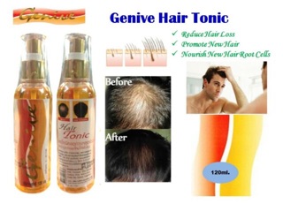Chai xịt siêu kích mọc tóc GENIVE 120ml
