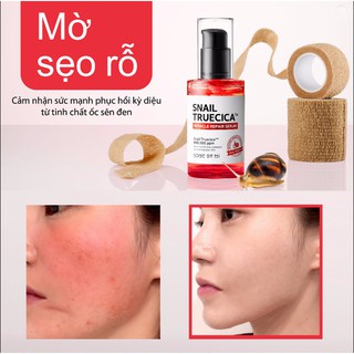 SERUM ỐC SÊN ĐỎ SOME BY MI 30ML