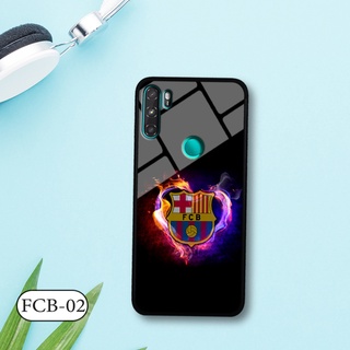 Ốp đội bóng VSMART ACTIVE 3 - Lưng kính cường lực