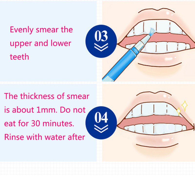 Bút Làm Trắng Răng Tức Thì Dạng Bút Xoay Peroxide Gel