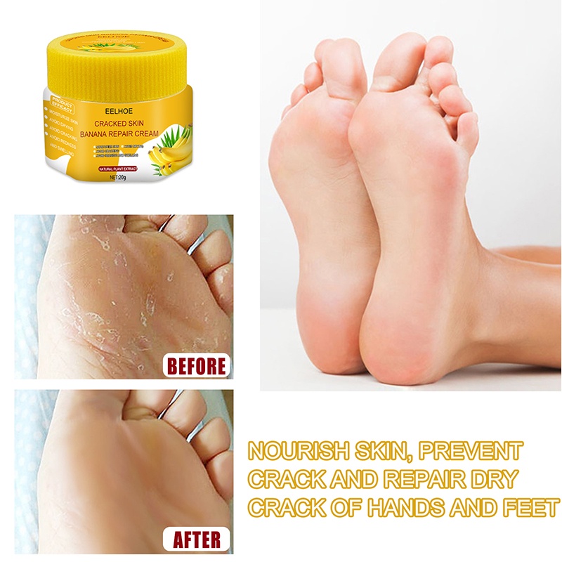 Kem dưỡng da chân 20g chiết xuất chuối thiên nhiên loại bỏ da chết chống khô nứt