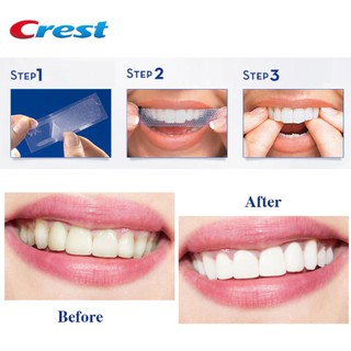 Miếng dán trắng răng Crest 3D Whitestrips Professional Effects, 1 Hour Express