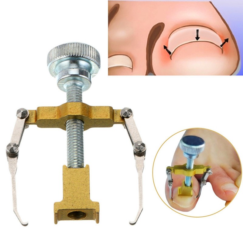 Dụng cụ tạo kiểu dáng lại cho móng chân